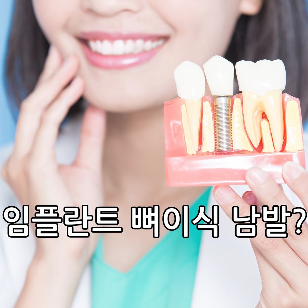 Read more about the article 부산 치과 잘하는곳, 임플란트 뼈이식 남발? : 사기 안당하는 방법